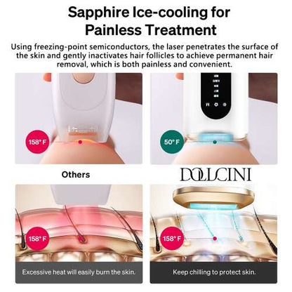 Dollcini IPL Epilator cu Laser – Tehnologie Gheață Rece, Pentru Întregul Corp