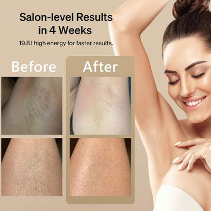 Dollcini IPL Epilator cu Laser – Tehnologie Gheață Rece, Pentru Întregul Corp
